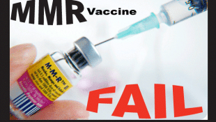 Malignant Mumps In MMR Vaccinated Children