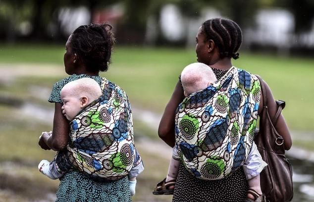 Tanzanian Albino Toddler is Found Mutilated and Dead
