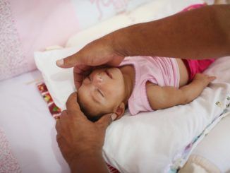 Authorities now say that the Zika virus causes autism