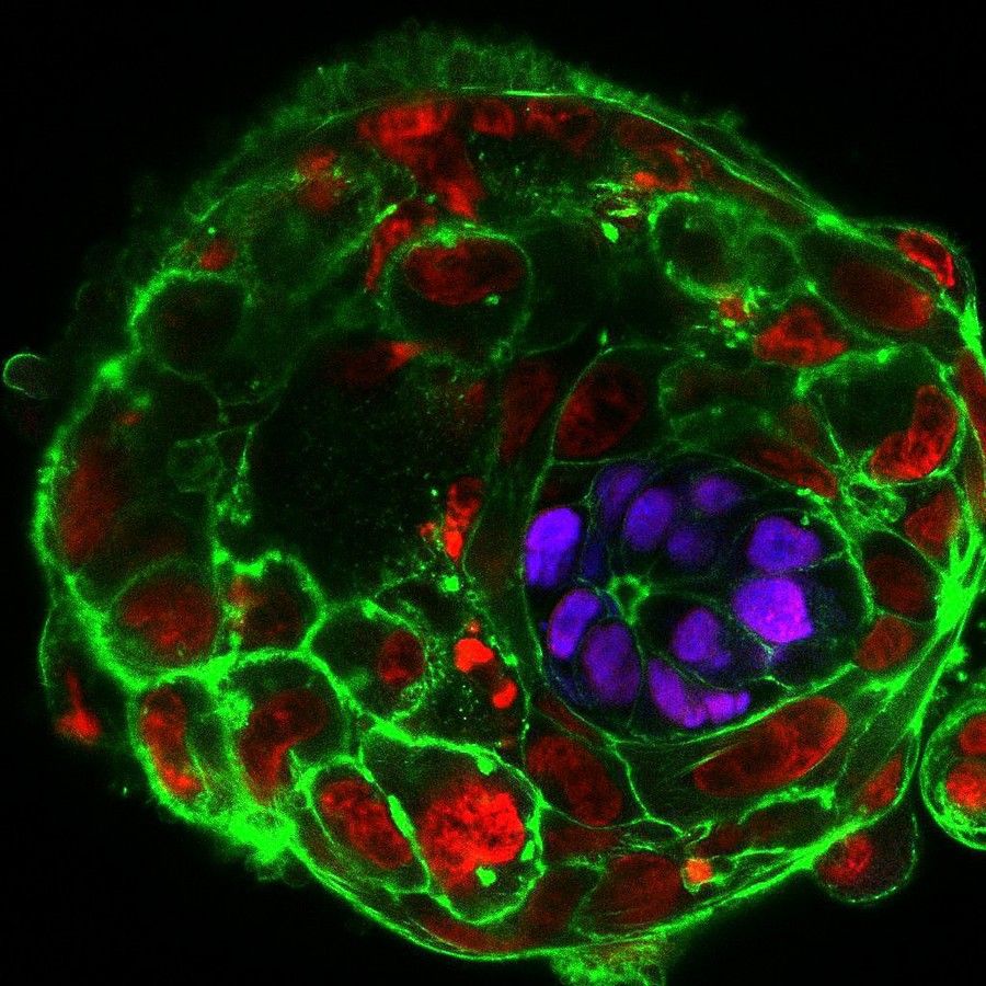 This image shows day 10 of embryo development © University of Cambridge 