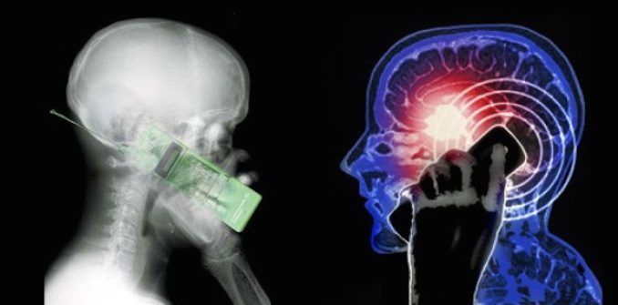 New study reveals that cell phones cause brain cancer