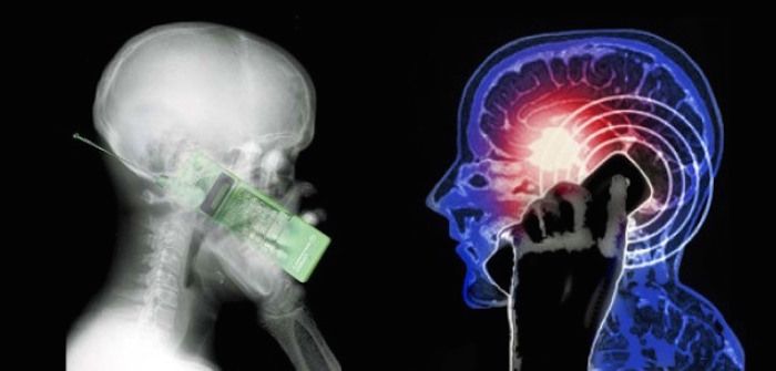 New study reveals that cell phones cause brain cancer
