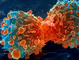 Scientists say cancer may actually be contagious