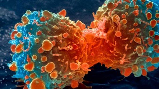 Scientists say cancer may actually be contagious
