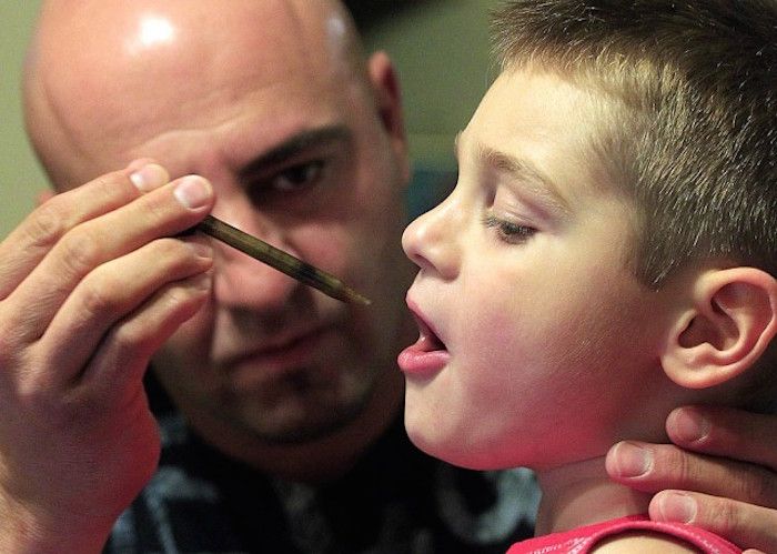 A father has appeared in a video online documenting the rapid progress made by his severely epileptic son while undertaking cannabis extract therapy.
