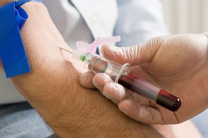 Doctors unveil world's first pre-cancer blood test