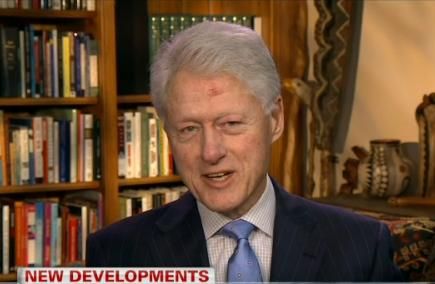 Bill Clinton appearing on CNN recently with an unexplained lesion on his forehead.