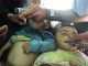 At least 36 children are dead and over 50 suffering allergic reactions after receiving measles vaccinations under a UN-sponsored program in the rebel-held north of Syria.