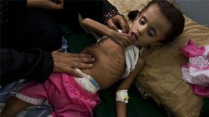UNICEF: Child Malnutrition At "All Time High" In Yemen