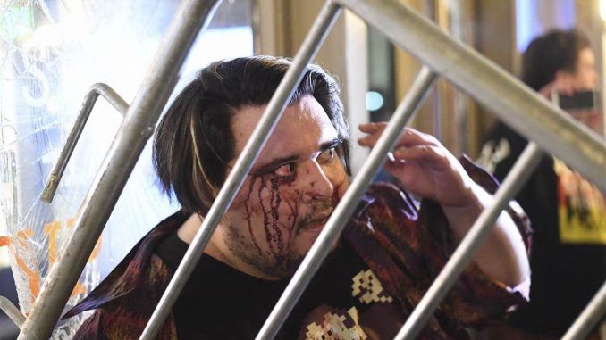 UC Berkeley staff beat milo audience member to a bloody pulp