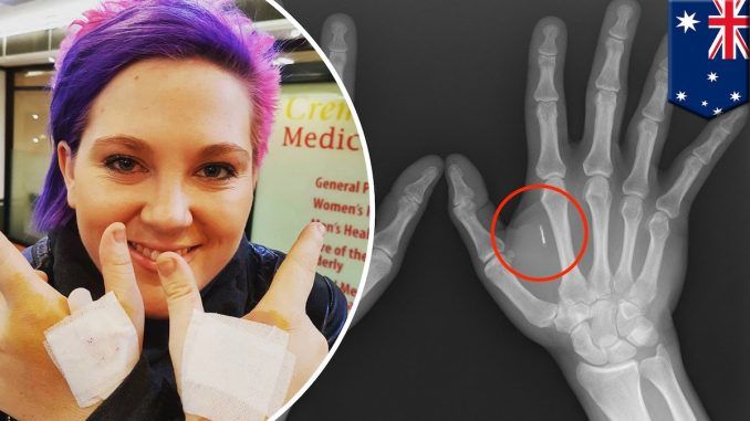 Australia has become the first widely microchipped nation, with Australians readily parting with $150 of their own money to pay for "fashionable" chip implants under their skin - without stopping...