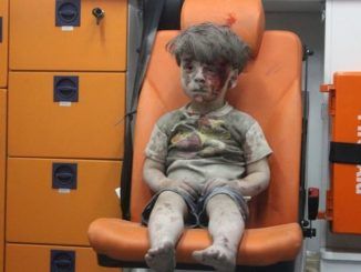 White Helmets lied about Aleppo Boy's injuries, admits father
