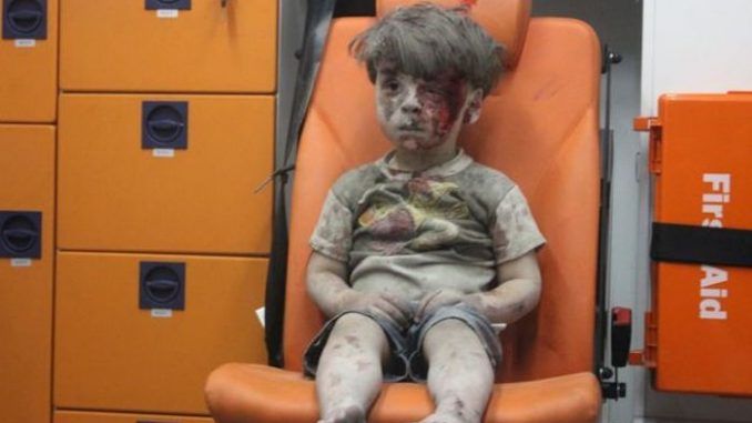 White Helmets lied about Aleppo Boy's injuries, admits father