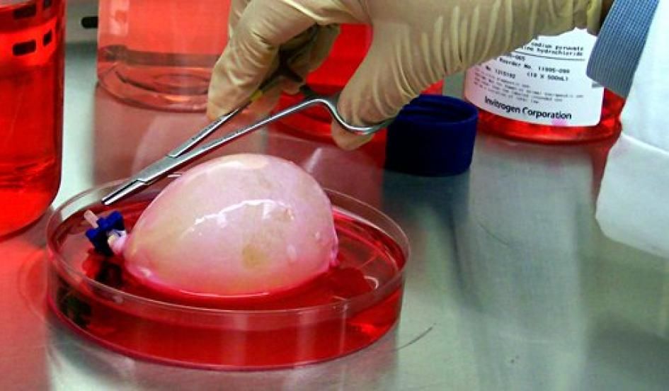 Gene engineering tool allows scientists to grow organs for transplants