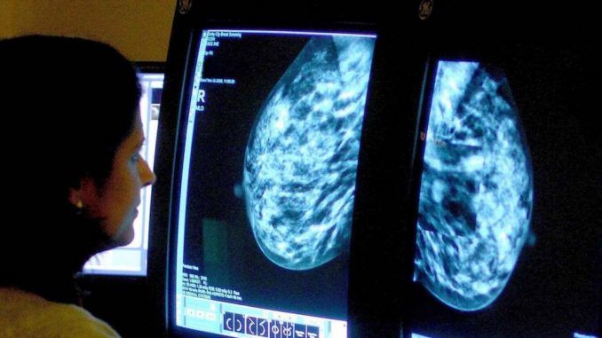 Women with high cholesterol less likely to develop breast cancer, scientists say
