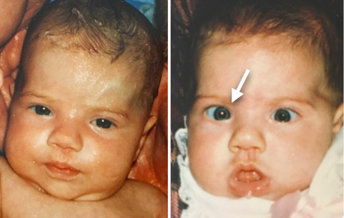 baby-vaccines-crooked