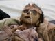 400k children starving to death in Yemen, UN report finds