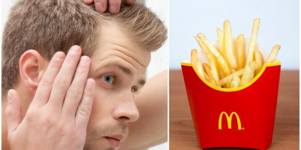 McDonald's may cure baldness, according to scientists