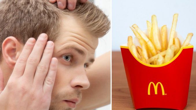 Mcdonald S Fries Cure Baldness Scientists Say The People S Voice