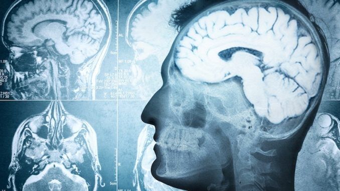 US scientists say they have found a link between people who are Christian and brain damage