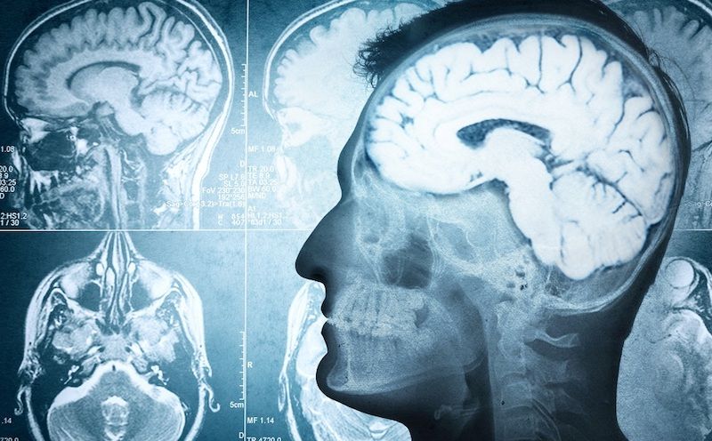 US scientists say they have found a link between people who are Christian and brain damage