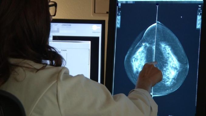 Chemotherapy is completely useless for breast cancer patients, study finds