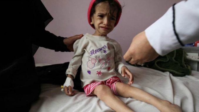 Yemen on brink of worse famine in 100 years
