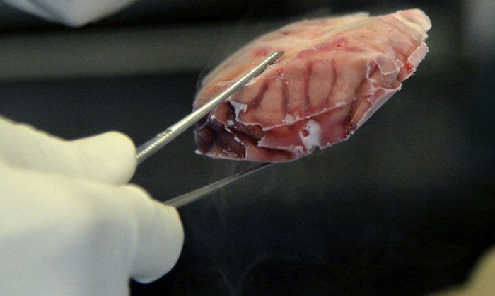 Lab-grown organs begin developing brain cells