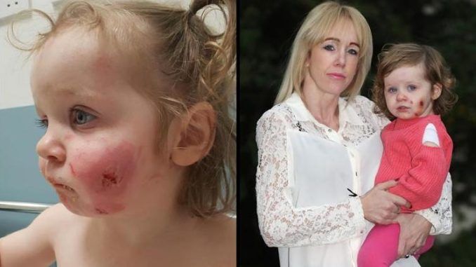 A toddler has been scarred for life after being bitten 15 times by boys who "took at least ten chunks" out of her and then "strangled" her.