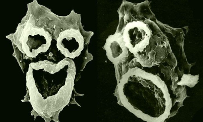 Brain-eating amoeba found in US tap water
