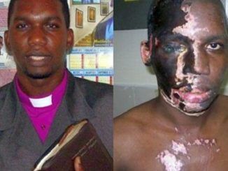A Christian pastor who was attacked with acid by Muslims shouting "Allahu Akbar" has survived the harrowing ordeal and now has an important message to share with the entire world. 