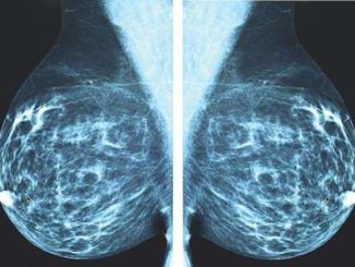 X-ray Mammography is accelerating cancer epidemic, top doctor warns