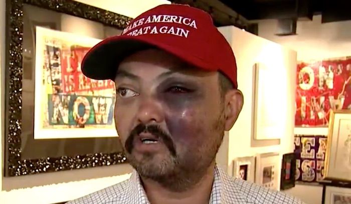 New York City man assaulted by teens for wearing MAGA hat