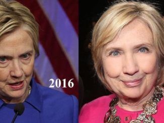 According to a leading aesthetic doctor, Hillary Clinton appears to have had some extensive work done on her face, as the 72-year-old appeared wrinkle-free and without her trademark heavy eye bags.