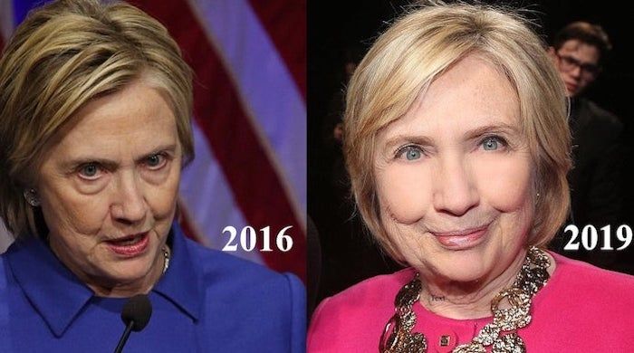 According to a leading aesthetic doctor, Hillary Clinton appears to have had some extensive work done on her face, as the 72-year-old appeared wrinkle-free and without her trademark heavy eye bags.