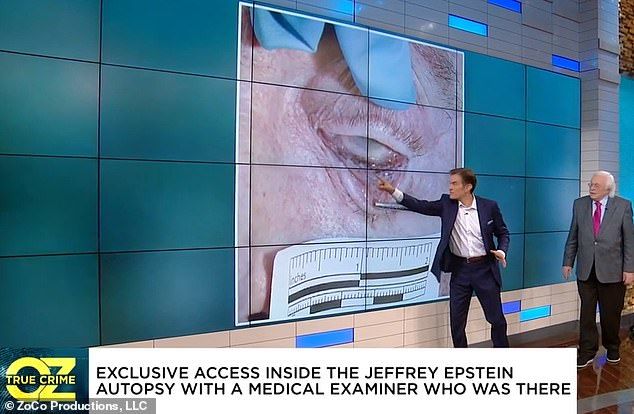 Dr. Oz and Dr. Michael Baden examine Jeffrey Epstein's injuries after his death in an episode of The Dr. Oz Show which will air on Thursday. 