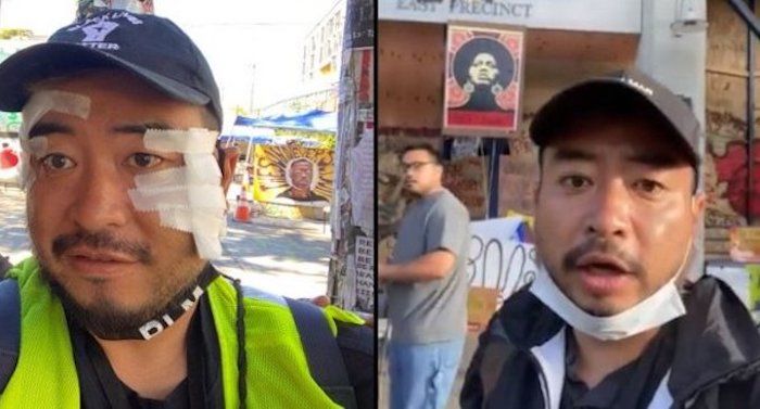 A Japanese artist and reporter who went to Seattle to cover the Capitol Hill Autonomous Zone was severely beaten up.