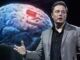 Elon Musk brain chip
