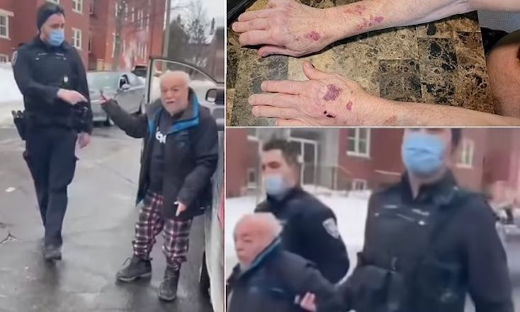 Canadian great-grandpa beaten to a bloody pulp by Trudeau's troops for honking in solidarity with Freedom Convoy