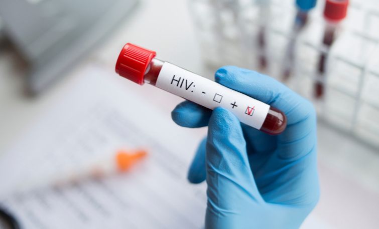 Mainstream media now encouraging vaxxed individuals to take HIV drugs