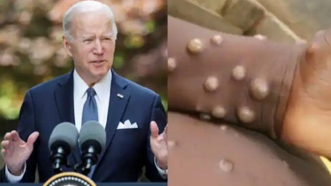 President Joe Biden warns that monkeypox pandemic is coming in time for the midterms