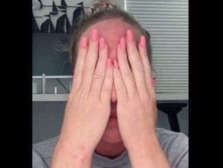 Woman sobs are vaccine injury results in her face melting off