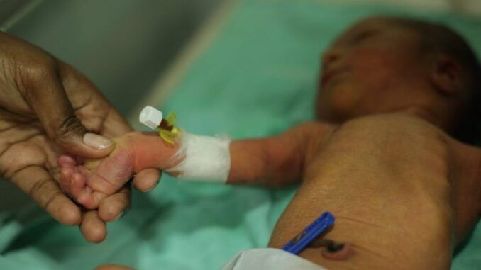 Hospital reveals explosion among vaxxed pregnant mothers in stillbirths