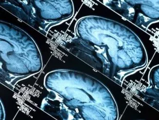 EU study concludes COVID jabs cause brain damage