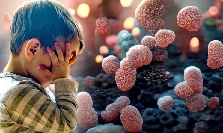 Study confirms link between bad gut health and autism