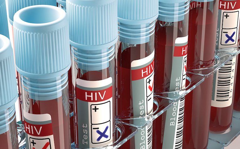 ACLU files lawsuit to allow criminals to intentionally spread HIV