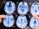 Scientists say Alzheimer’s is caused by brain fungal infection