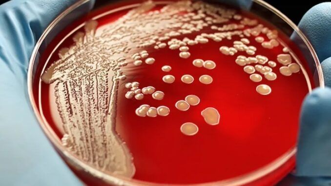 Super gonorrhea to be next pandemic out of China, CDC warns.