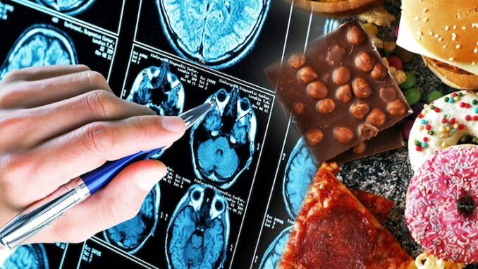 Study concludes processed foods cause dementia