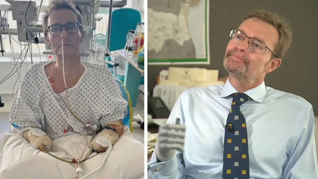 British MP Who Pushed Covid Vaccines on Public Undergoes Quadruple Amputation After Hands and Feet Turn Black